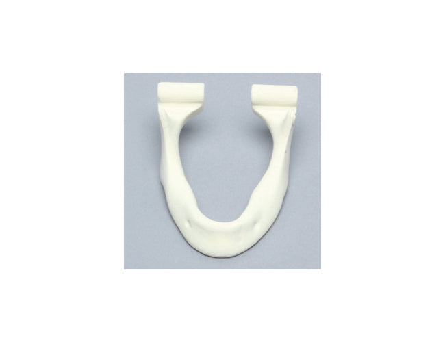 Mandible with Knife Ridge Deformity